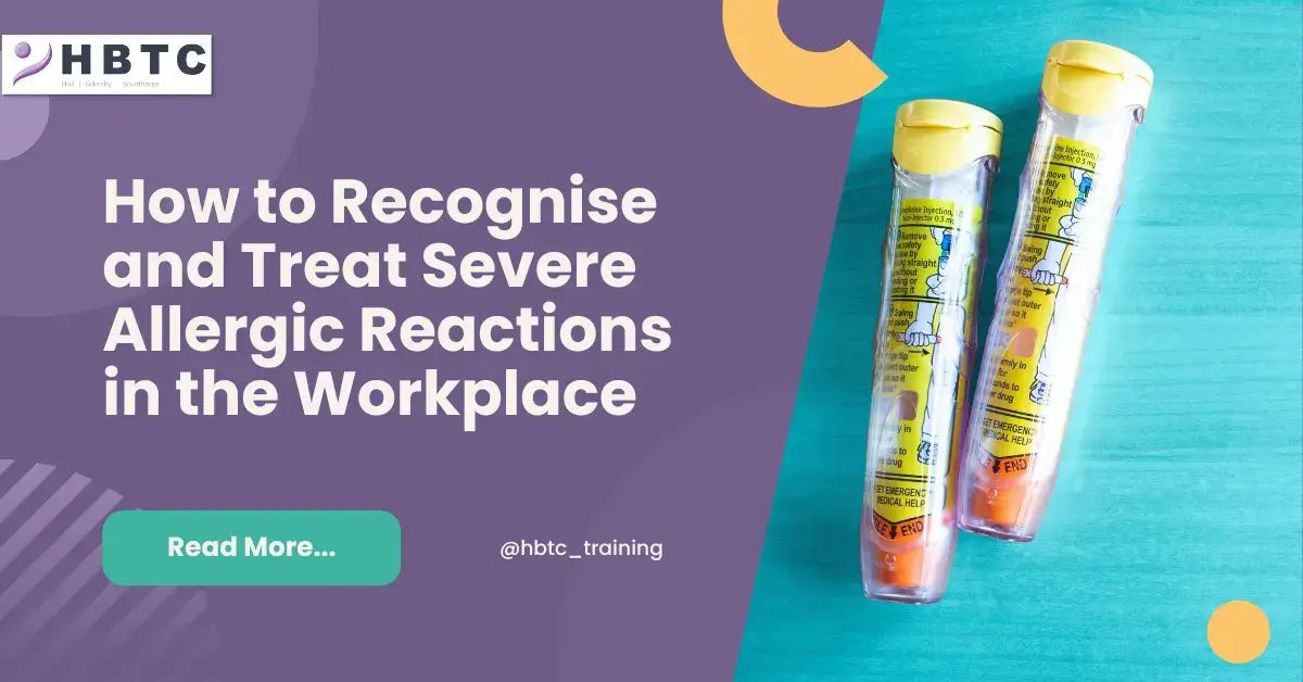 How to Recognise and Treat Severe Allergic Reactions in the Workplace